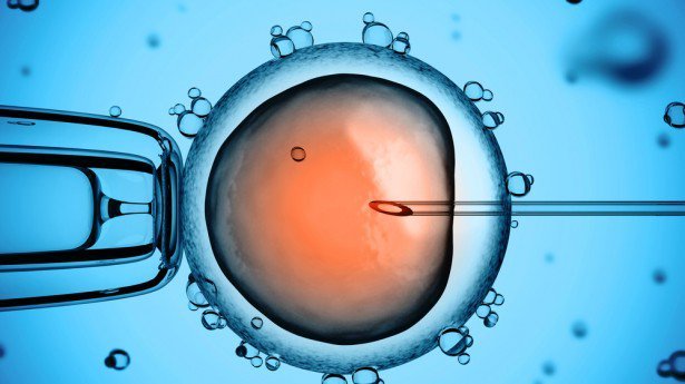 icsi IVF програма за мъже