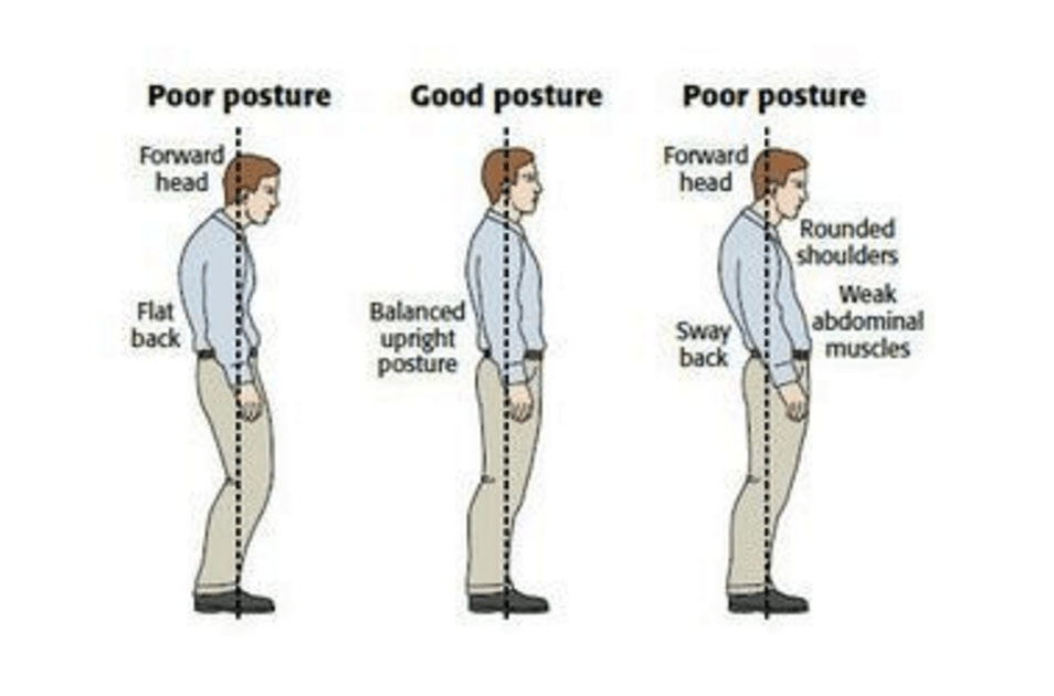 Източник на изображението: http://www.thephysiocompany.com/blog/stop-slouching-postural-dysfunction-symptoms-causes-and-treatment-of-bad-posture