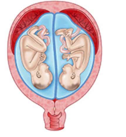 източник: http://raisingchildren.net.au/articles/twins_fraternal_and_identical.html/context/1641